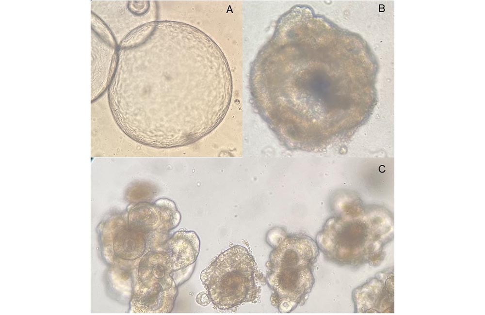 Mikroskopische Aufnahmen patientenspezifischer Organoidkulturen